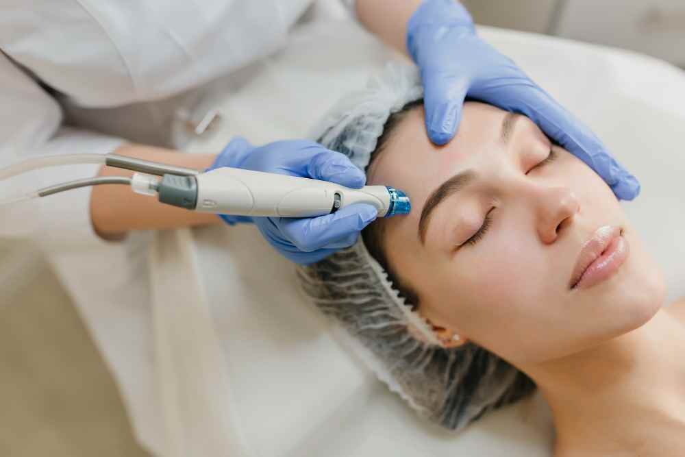 Microneedling Facial(3)(1)